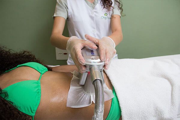 Lipocavitação