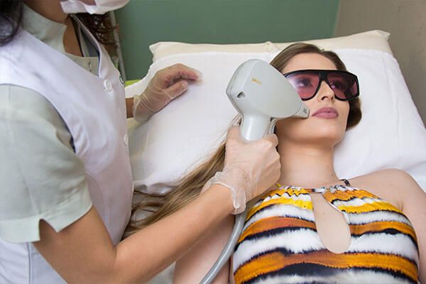 Peeling Facial